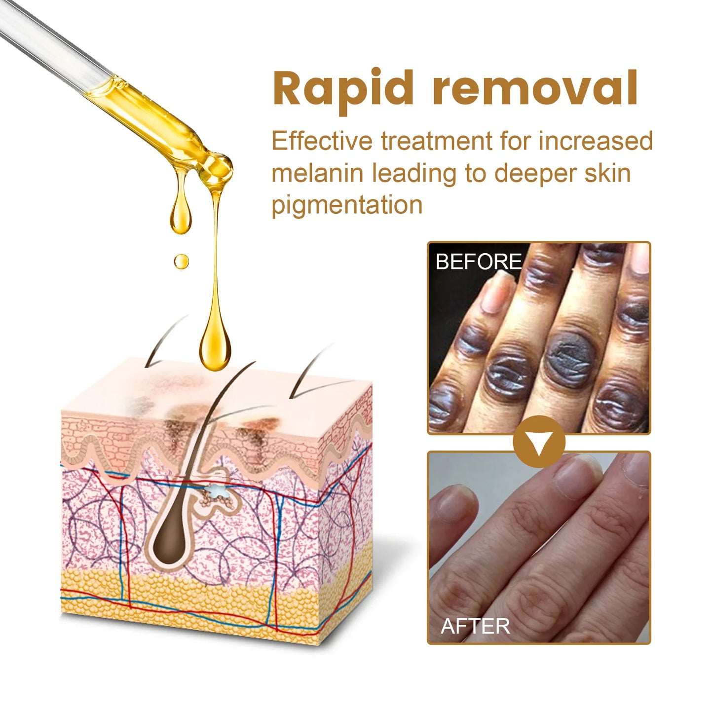 Finger Joint Black Acanthoderm essence Lighten Skin Melanin, Brighten Skin Tone and Moisturize Skin Care essence