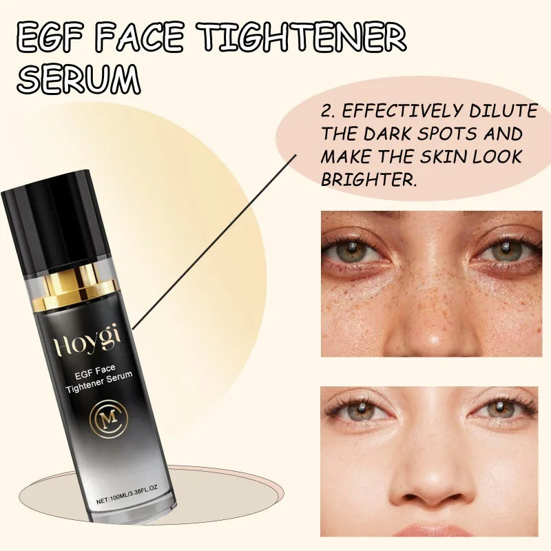 Face Tighten Serum Lighten Dark Spot Fade Fine Line Wrinkle Brightening Nourish Moisturizer Hydrating Face Serum