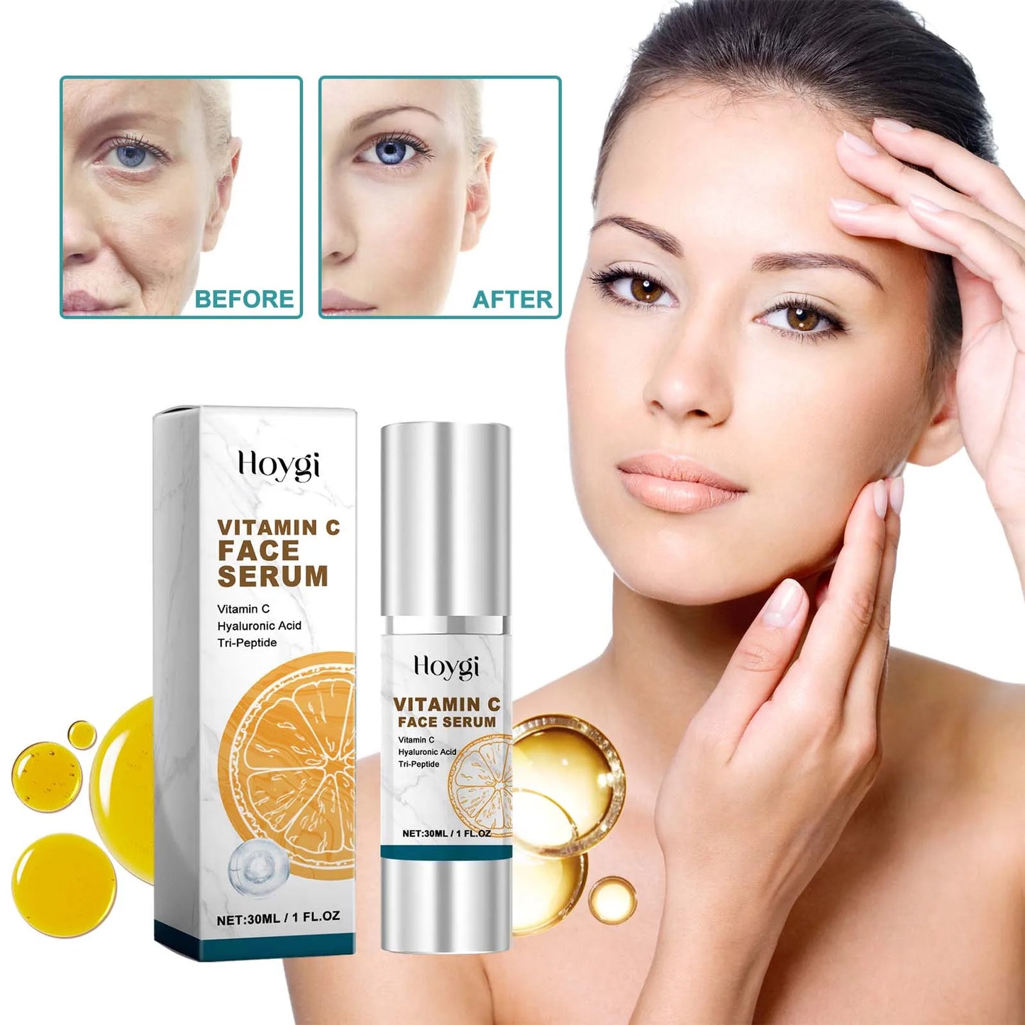 Melanin Correcting Serum Fade Dark Spots Anti Freckle Melasma Remover Lightening Pigment Blemish Vitamin C Face Essence