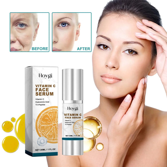 Melanin Correcting Serum Fade Dark Spots Anti Freckle Melasma Remover Lightening Pigment Blemish Vitamin C Face Essence