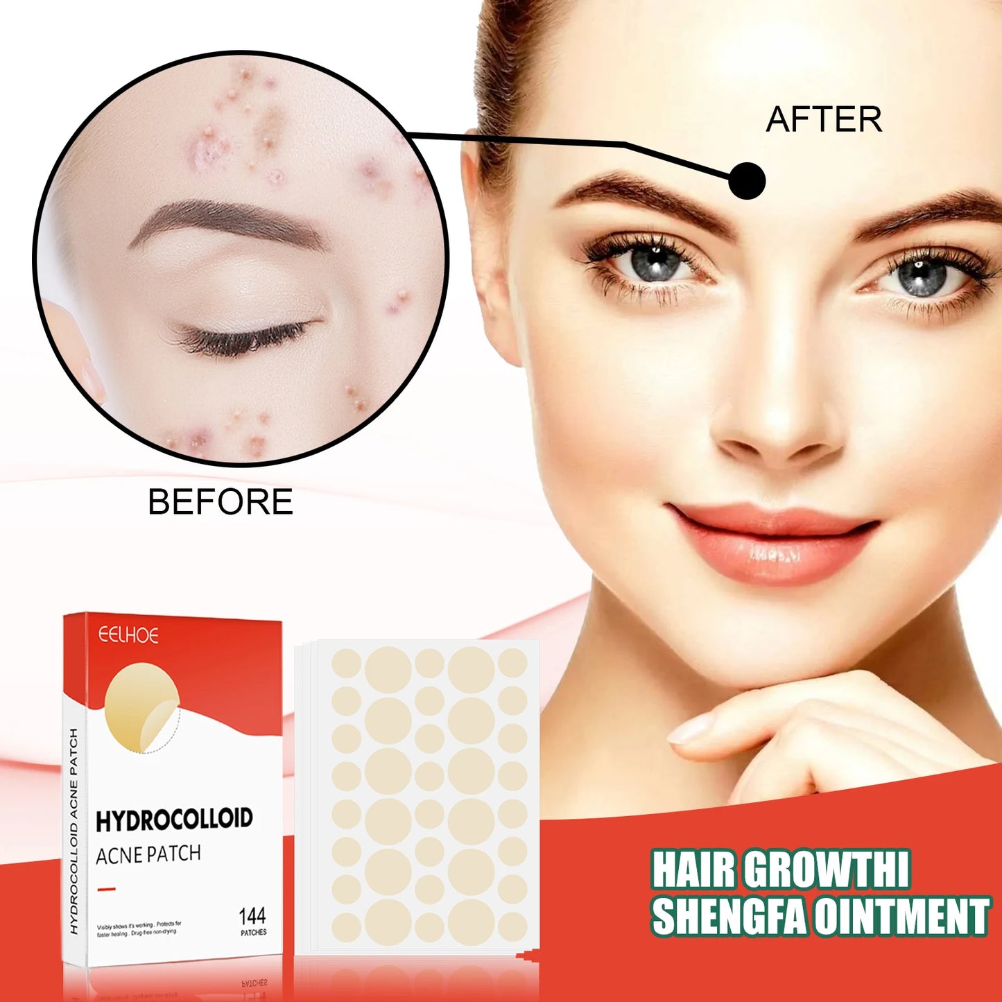 Hydrocolloid Acne Patch Acne Reduce Blackheads Spots Repair Waterproof Breathable Brighten Complexion Invisible Pimple Patch