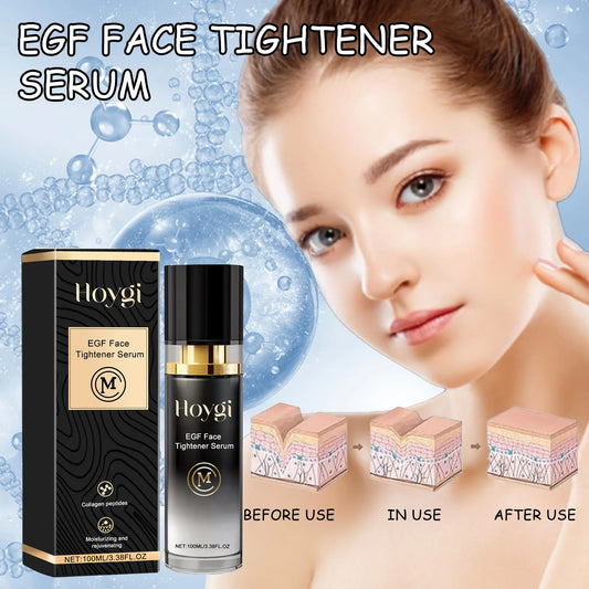 Face Tighten Serum Lighten Dark Spot Fade Fine Line Wrinkle Brightening Nourish Moisturizer Hydrating Face Serum