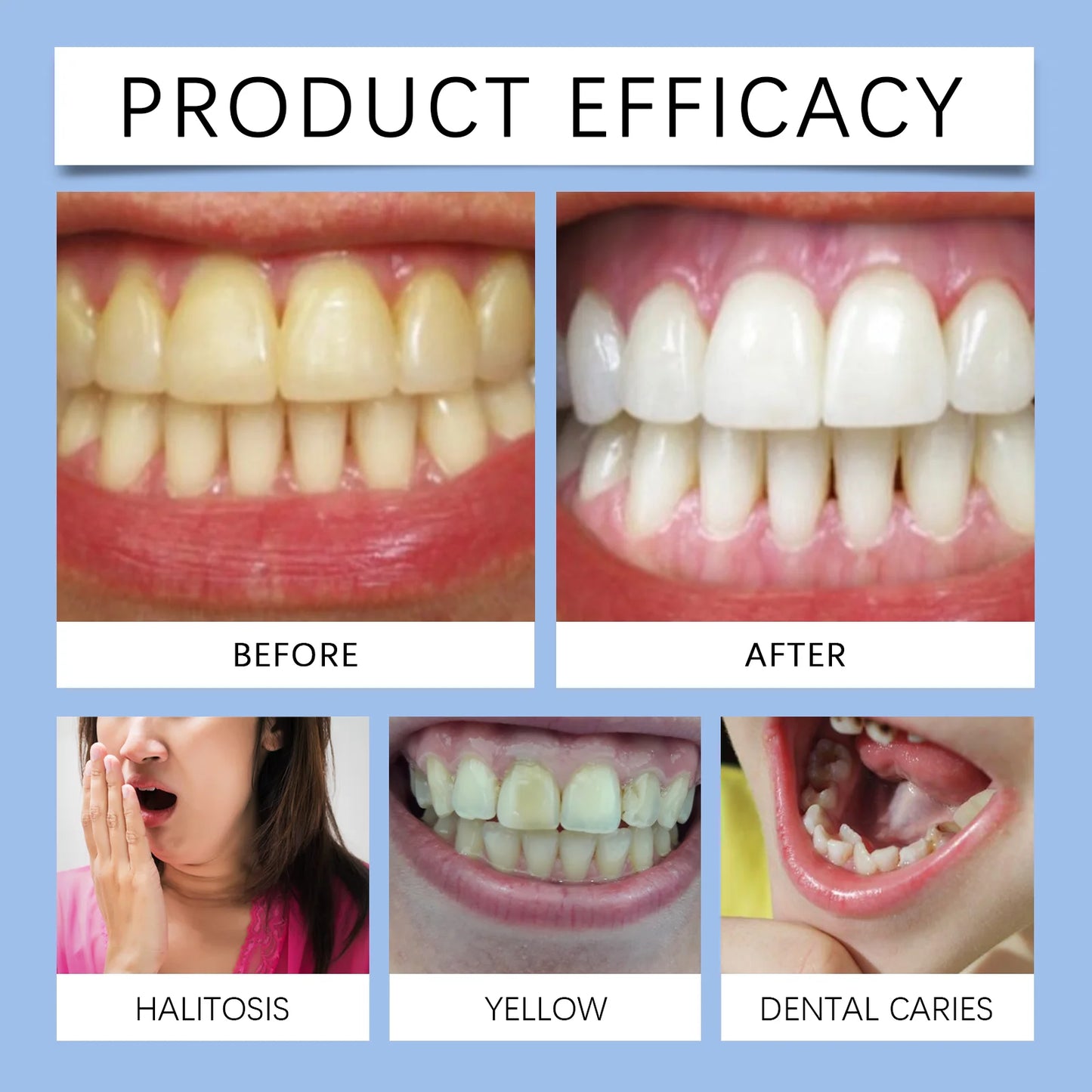 Mint Teeth Whitening Strips Freshening Bad Breath Soothing Gum Remove Yellow Teeth Oral Care Brightening Tooth Strips