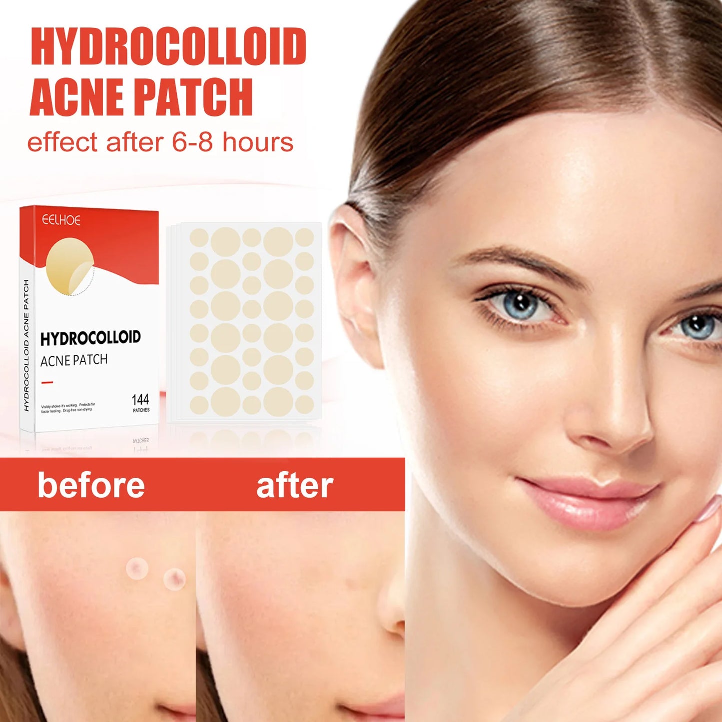 Hydrocolloid Acne Patch Acne Reduce Blackheads Spots Repair Waterproof Breathable Brighten Complexion Invisible Pimple Patch