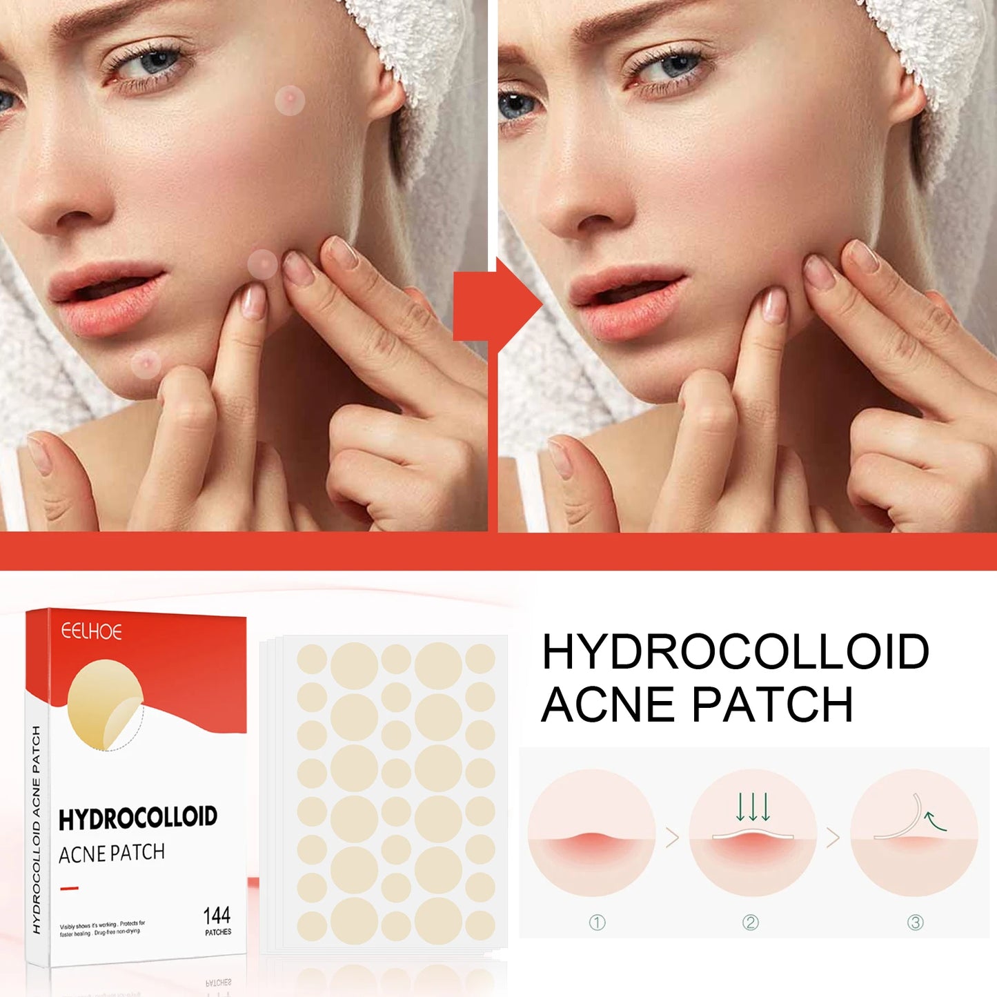Hydrocolloid Acne Patch Acne Reduce Blackheads Spots Repair Waterproof Breathable Brighten Complexion Invisible Pimple Patch