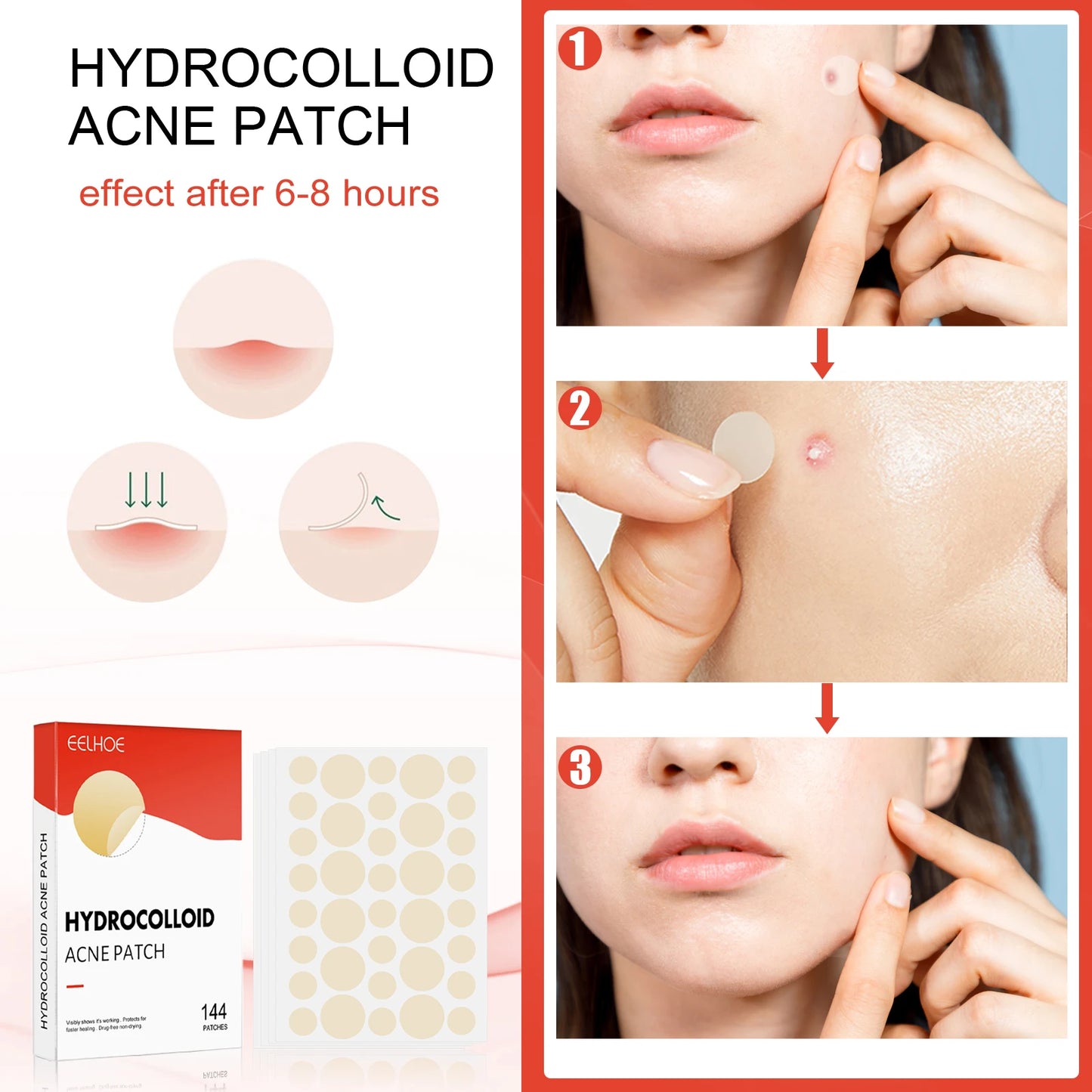 Hydrocolloid Acne Patch Acne Reduce Blackheads Spots Repair Waterproof Breathable Brighten Complexion Invisible Pimple Patch
