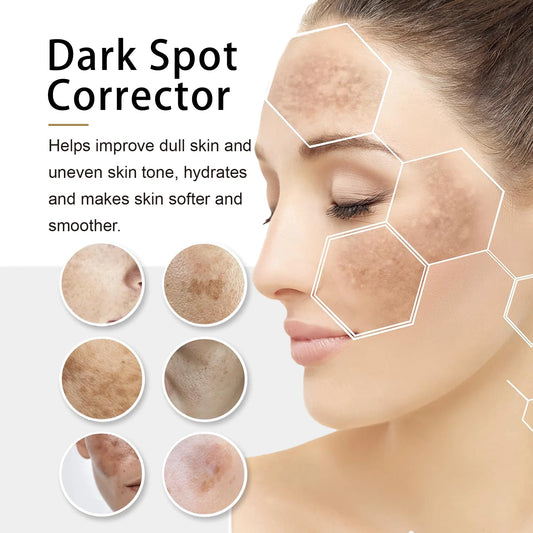 Dark Spot Corrector Repair Cream Lightens Fine Lines Hydrating Moisturizing Mild Lightens Uneven Skin Tone Dull Skin Cream