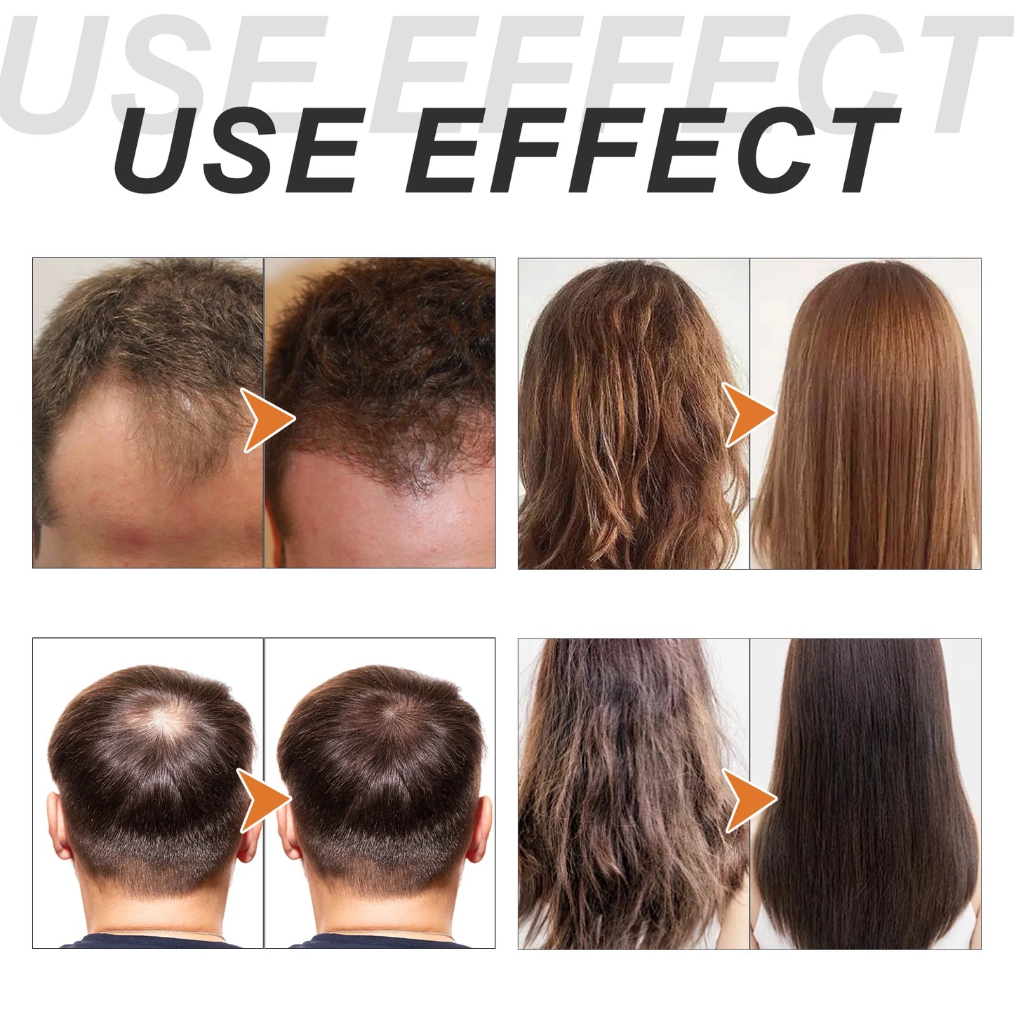 Moisturize Nourish Repair Hair & Scalp Hydrated Soft Light Non-greasy Promotes Thicker Stronger Anti Hair Loss Bi-phase Essence