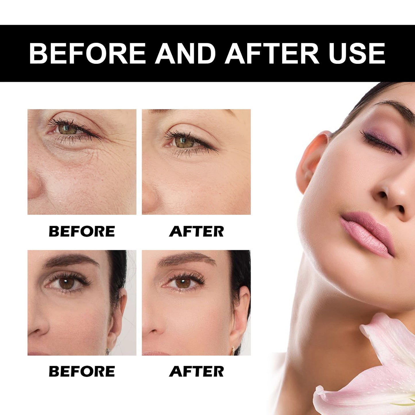 Vitamin C Serum For Face Dark Spot Removal Niacinamide Moisturizing Brightning Shrink Pores Essence Beauty Firming Skincare