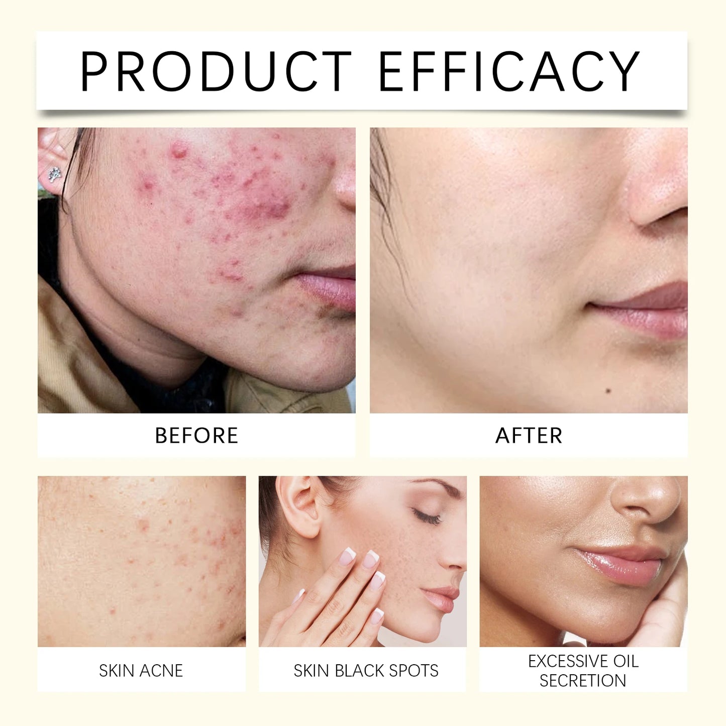 Facial Cleansing Honey Turmeric Soap for Acne Prone Skin Deep Cleansing Pores Brightening Glow Gentle Daily Cleanser Skincare