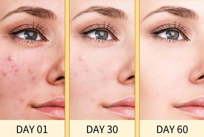 Facial Cleansing Honey Turmeric Soap for Acne Prone Skin Deep Cleansing Pores Brightening Glow Gentle Daily Cleanser Skincare