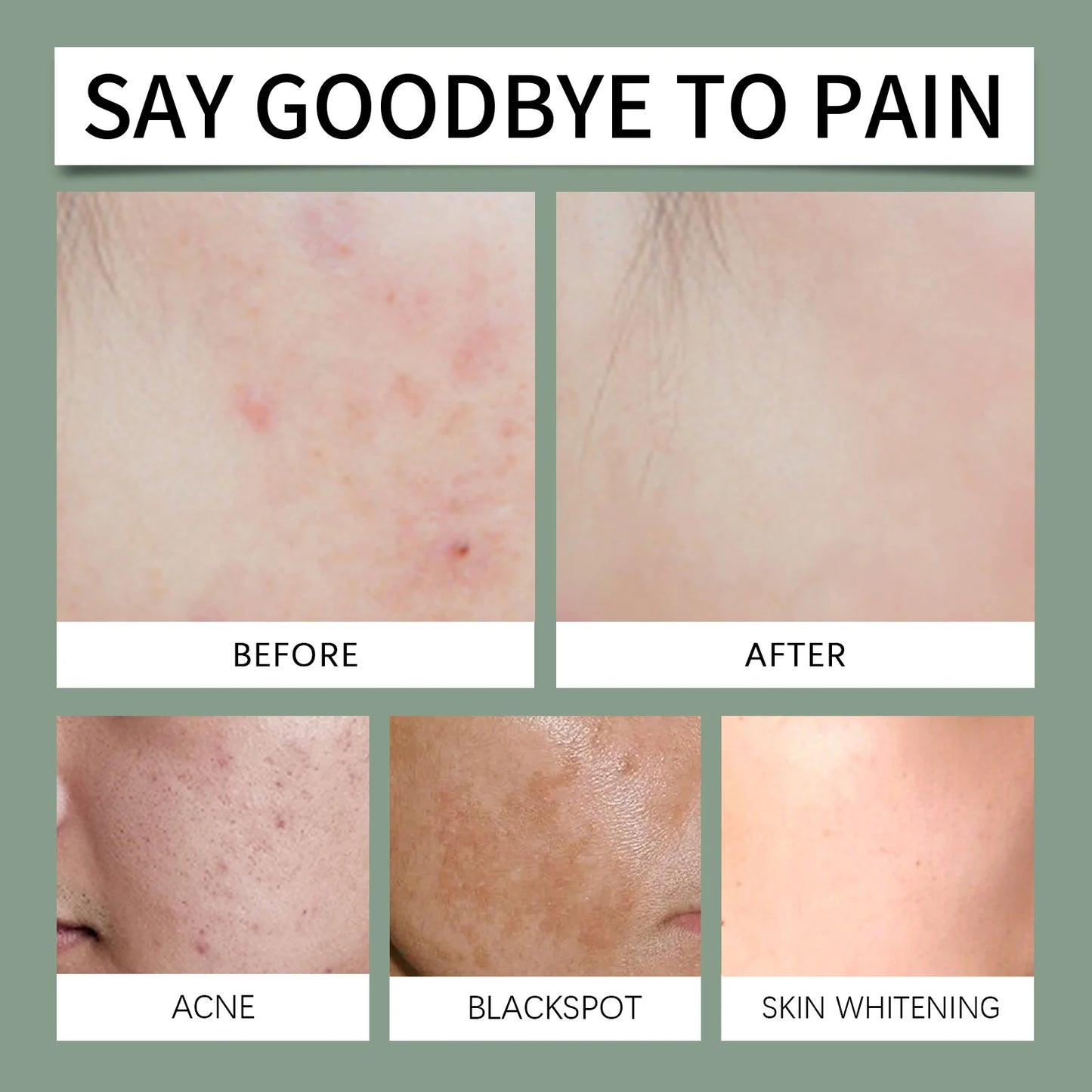 Facial Cleansing Care Soap Gentle Cleansing Elastic Delicate Improves Skin Texture Moisturizing Remove Acne Nourishing Soap