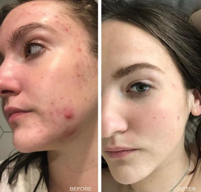 Facial Cleansing Care Soap Gentle Cleansing Elastic Delicate Improves Skin Texture Moisturizing Remove Acne Nourishing Soap