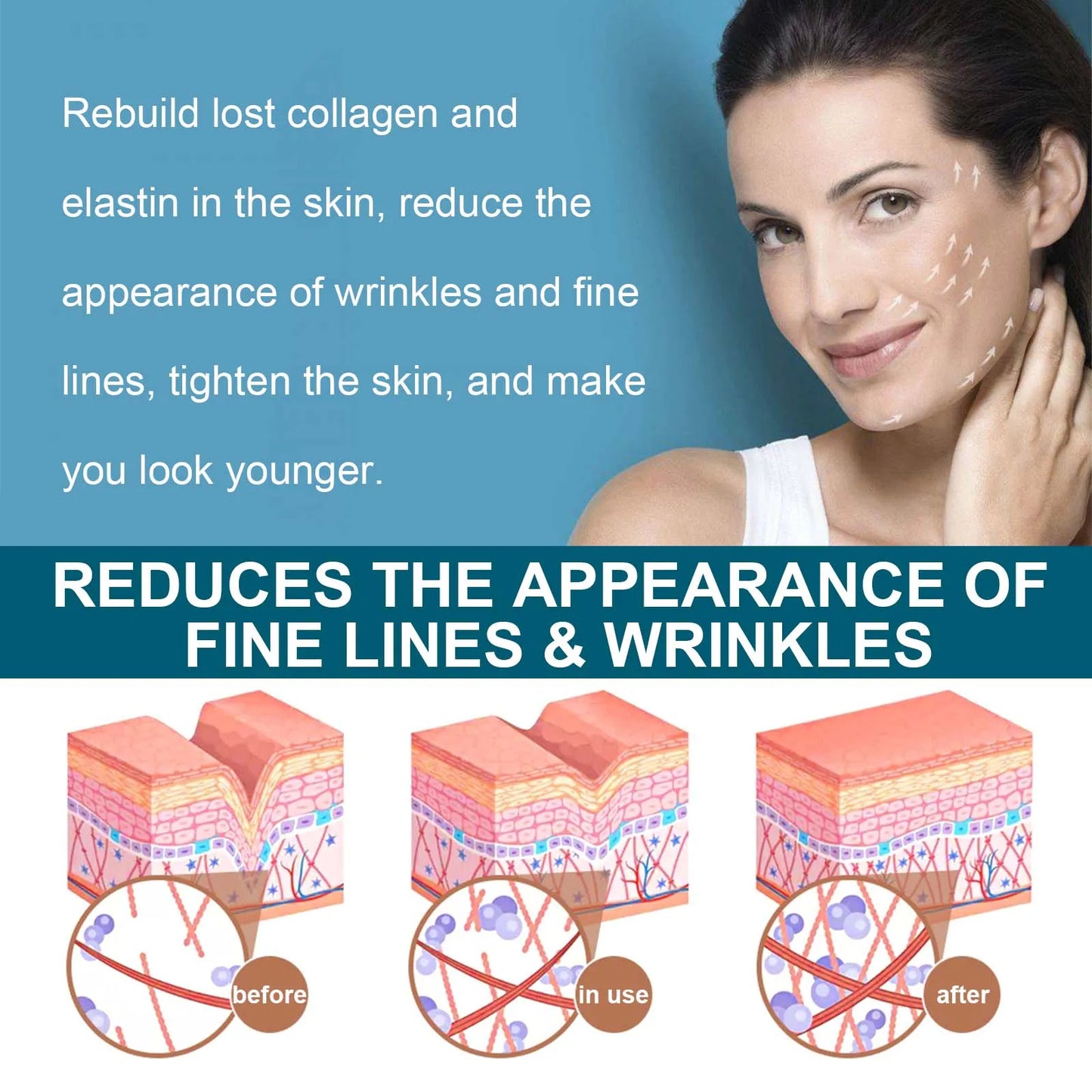 Melanin Correcting Serum Fade Dark Spots Anti Freckle Melasma Remover Lightening Pigment Blemish Vitamin C Face Essence