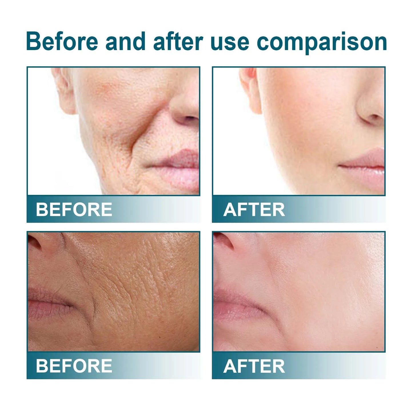 Melanin Correcting Serum Fade Dark Spots Anti Freckle Melasma Remover Lightening Pigment Blemish Vitamin C Face Essence