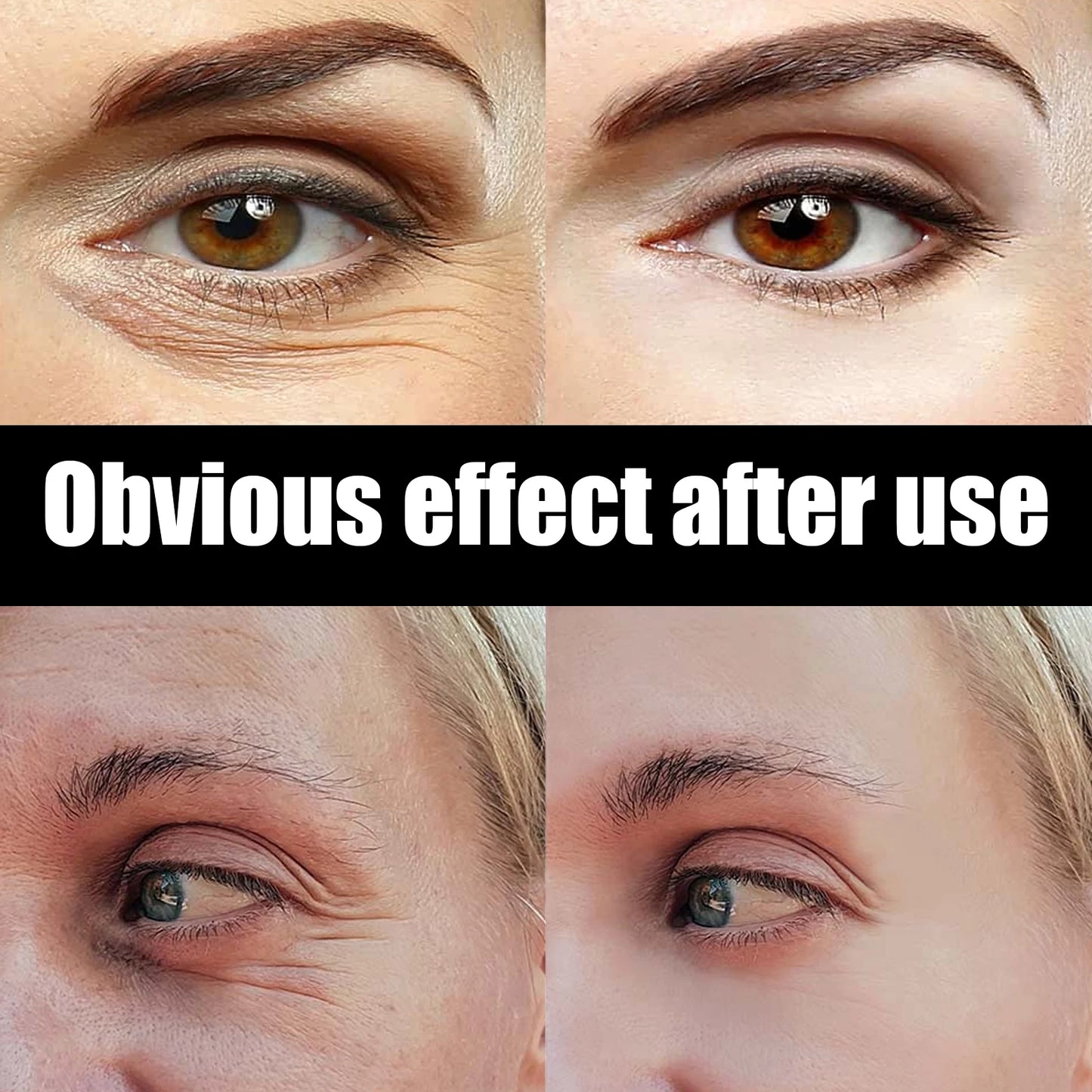 Eye Care Cream Improve Dryness & Dehydration Skin Leaving Skin Around the Eyes Moist, Delicate and Smooth Brightening Eye Cream