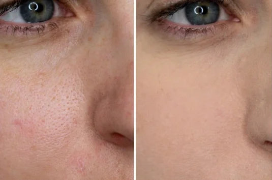 Pink Rose Clay Apply Facial Mask Clean pores & Hydrating Moisturizing Facial Treatment Radiance Boosting Skincare for All Skin