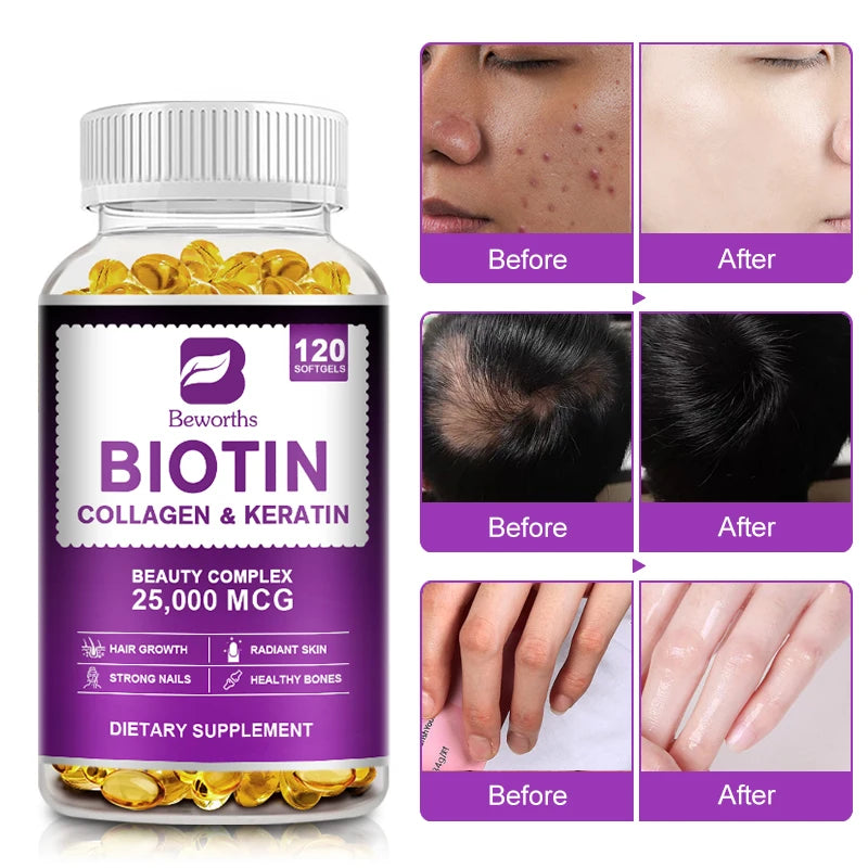 Collagen & Biotin Capsule Biotin for Hair Growth Strong Hair Dry Hair Follicle Repair Skin Hydrolyzed Adult Beauty Care
