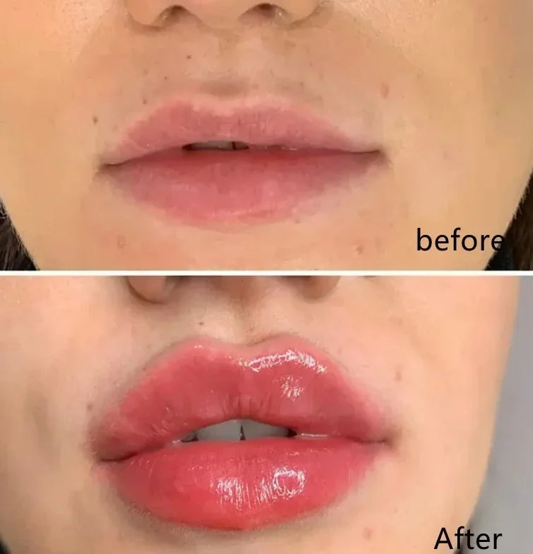 Lip Enriching Essence Lip Moisturizing Anti Cracking Plump Tender and Fade Lip Lines Dudu Lip Lotion Gloss Serum Cosmetics