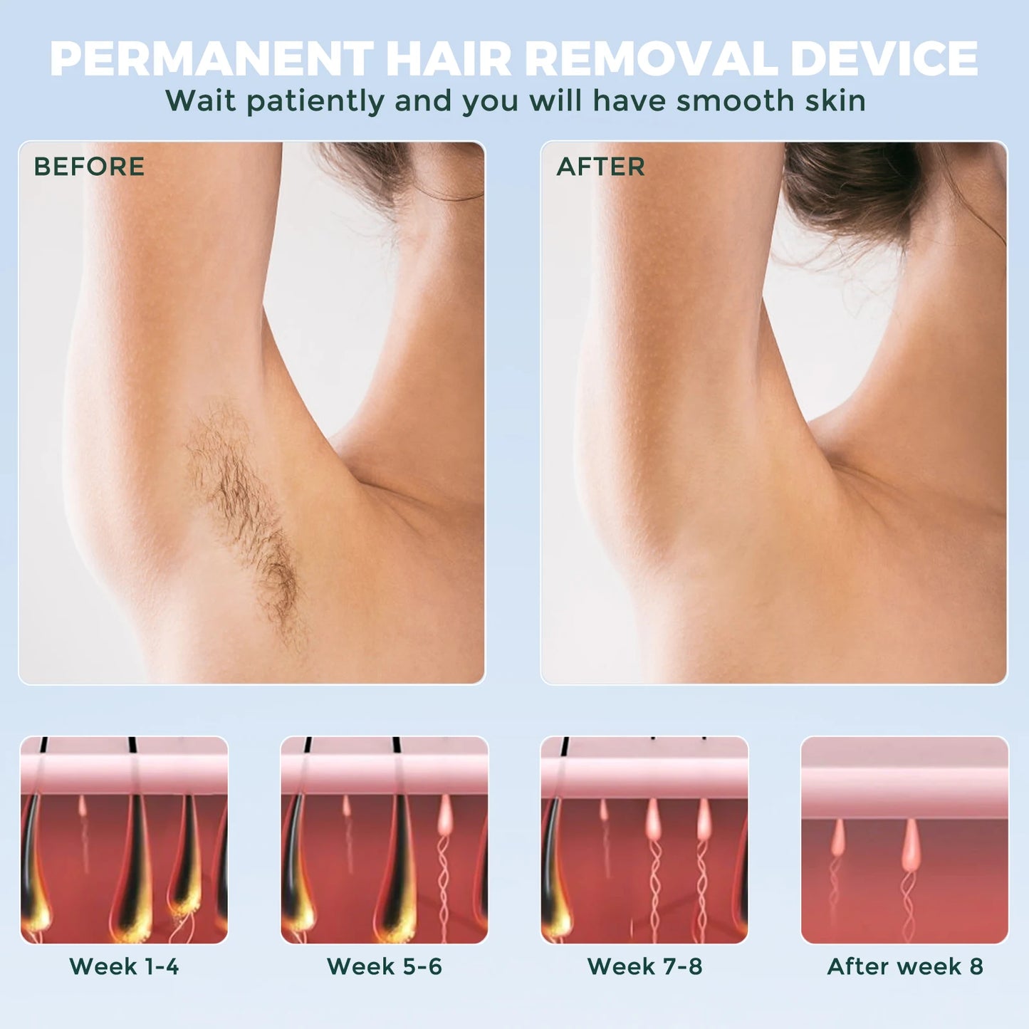 Portable IPL Laser Epilator 5 Modes - Painless, Permanent Hair Removal for Women’s Full Body, Bikini, Leg, Face, Underarm