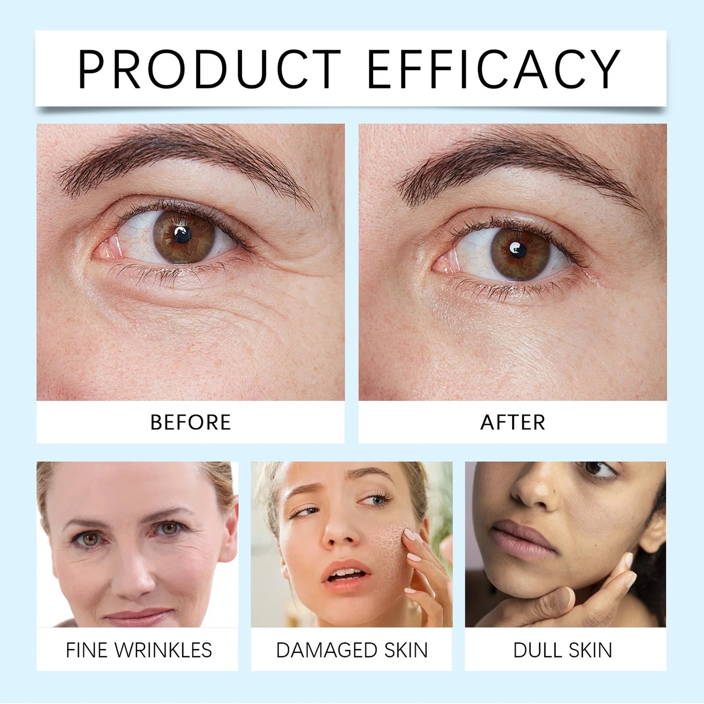 Neck Wrinkle Protein Cream Hyaluronic Acid Facial Essence Lightens Fine Lines and Lifts The Neck Product Nourishes and Moisturizes