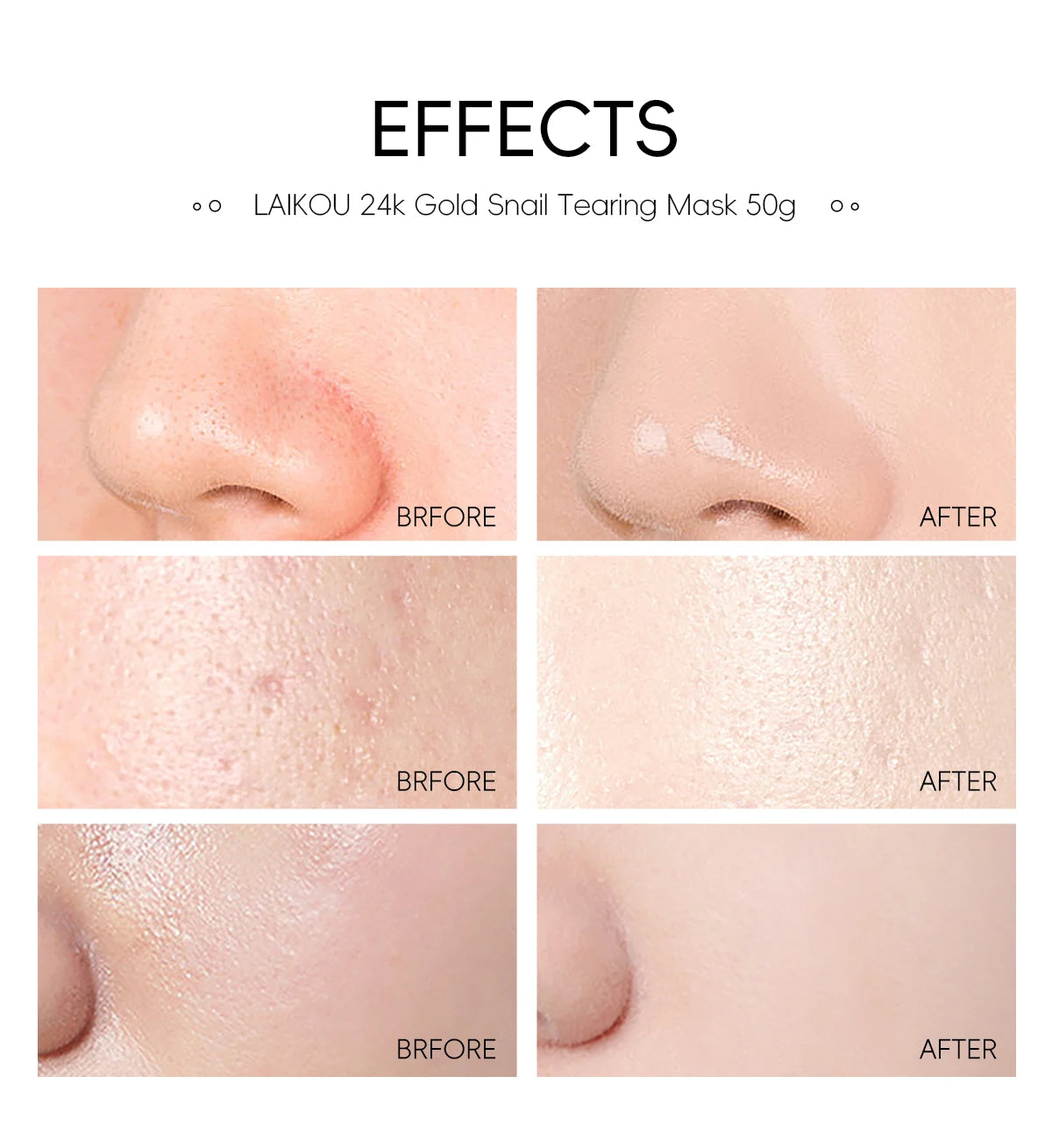 24K Gold Snail Peel-Off Mask 3PCS Deep Cleansing Pore Tightening Blackhead Removal Detoxifying Facial Treatment